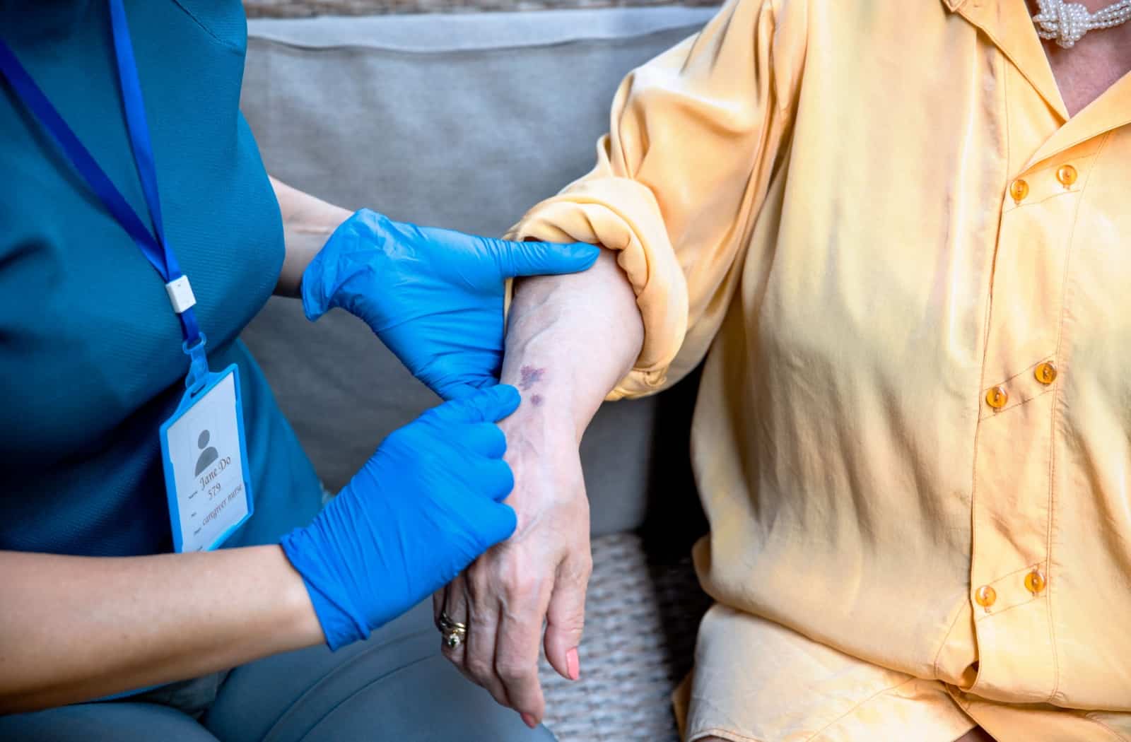 A nurse examines a bruise on an older adult's arm.